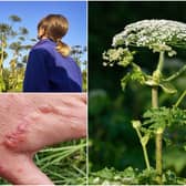 Warnings have been issued over the giant hogweed plant (Photos: Shutterstock)