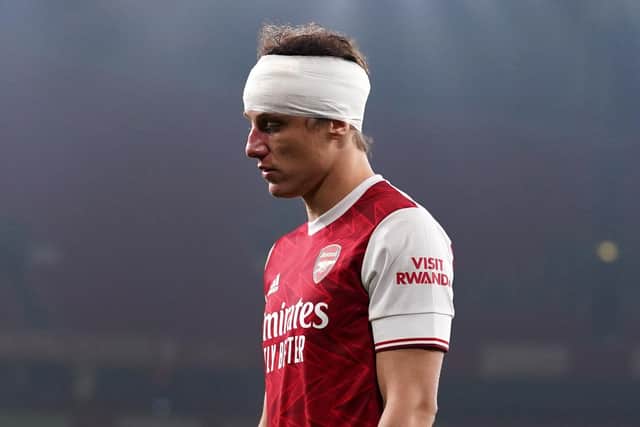 Arsenal's David Luiz wears a bandage on his head during the Premier League match at the Emirates Stadium, London. Photo: John Walton/PA Wire.