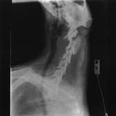 The embedded fish hook is visible in this X-ray of the dog before it was removed in an emergency surgical procedure