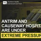 Antrim Area Hospital ahnd Causeway Hospital are under extreme pressure.