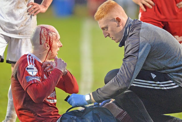 Portadown's Greg Hall who was injured during the game. INPT19-217.
