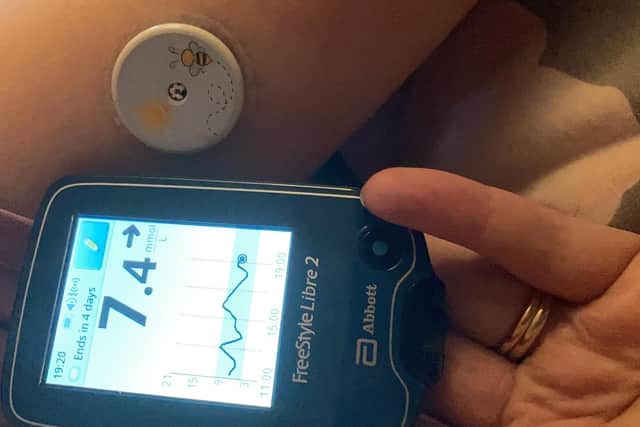 Harriet’s glucose monitoring technology.