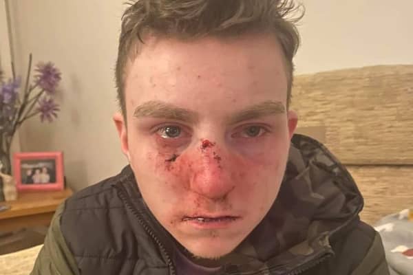 Callum Crawford, (21)  who was seriously injured in an attack in Portadown, Co Armagh at the weekend. The PSNI is treating the attack as a disability hate crime. Photo courtesy of the Crawford family.