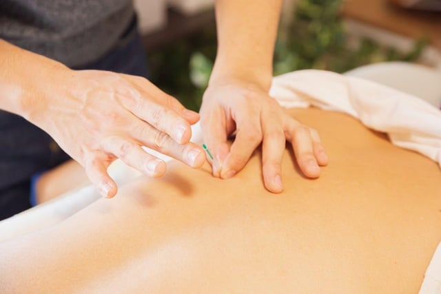 Derived from ancient Chinese medicine, acupuncture refers to when fine needles are inserted in specific areas of the body for therapeutic and preventative purposes.
It is believed that the central nervous system can be stimulated through various acupuncture points, releasing chemicals into the muscles, spinal cord and brain in order to bring about the body’s natural healing abilities. 
Bodytone Physiotherapy has over 15 years of experience in using acupuncture to ease muscle pain, release knots and relieve spasms.