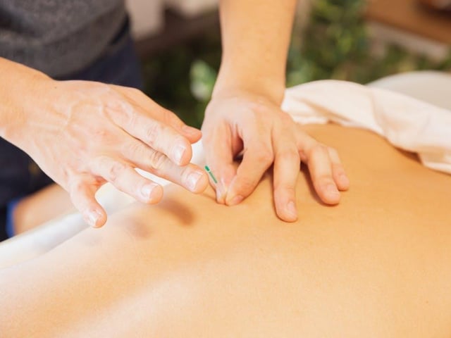 Derived from ancient Chinese medicine, acupuncture refers to when fine needles are inserted in specific areas of the body for therapeutic and preventative purposes.
It is believed that the central nervous system can be stimulated through various acupuncture points, releasing chemicals into the muscles, spinal cord and brain in order to bring about the body’s natural healing abilities.
Bodytone Physiotherapy has over 15 years of experience in using acupuncture to ease muscle pain, release knots and relieve spasms.