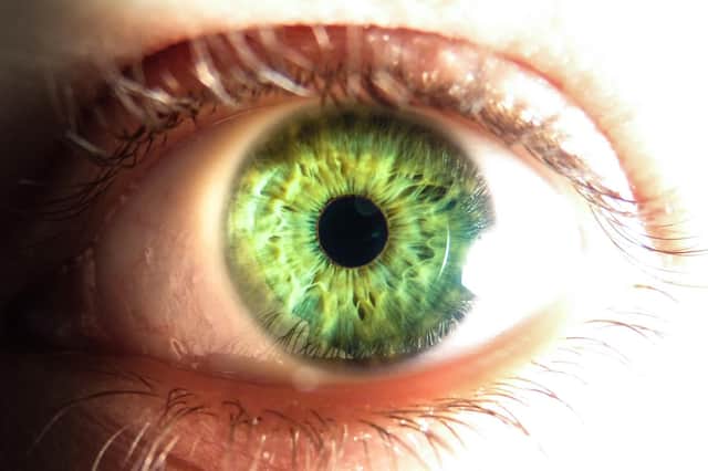 Corneal blindness is the fourth most common cause of blindness in the world.