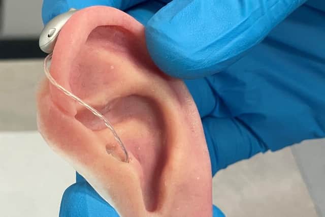 Stephen’s prosthetic ear with hearing aid attached. Pic credit: SEHSCT