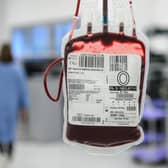 NHS bosses are particularly concerns about a lack of rare blood types