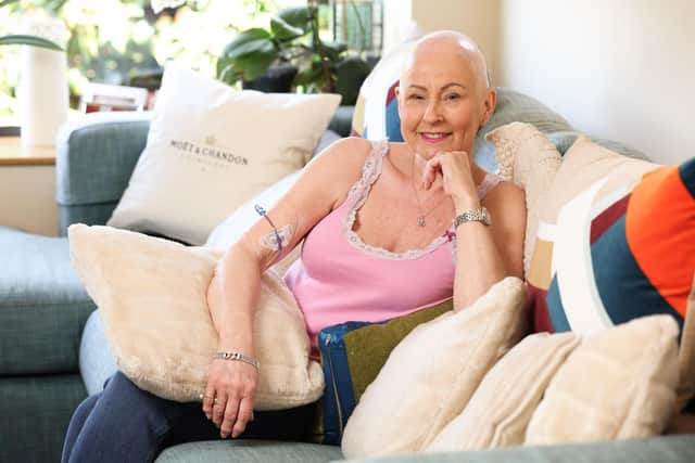 Pamela Ballantine pictured in May during the week of her final chemotherapy treatment. Picture: Kelvin Boyes / Press Eye.