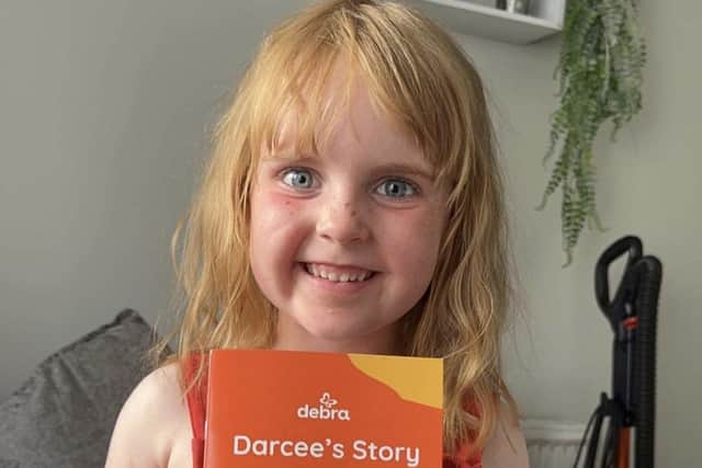 Darcee Birrane, aged five, is the cover star of a new book about  epidermolysis bullosa (EB) simplex, also known as Butterfly Skin. Darcee, who starts school this week, was diagnosed with the painful condition – which can leave her hands and feet covered in blisters at the lightest touch – when she was three weeks old. The book explains to pupils that Darcee, from Lisburn, is just like every other little girl who likes playing and drawing even though she sometimes needs to wear bandages. Pic credit: Family picture.