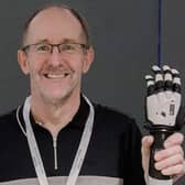 Local man Stephen Lowry said he can now do everything he needs with his new AI hand.