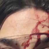 An injury sustained by one of the officers who was kicked multiple times to the head during one of the incidents on Wednesday, February 19. Picture: PSNI