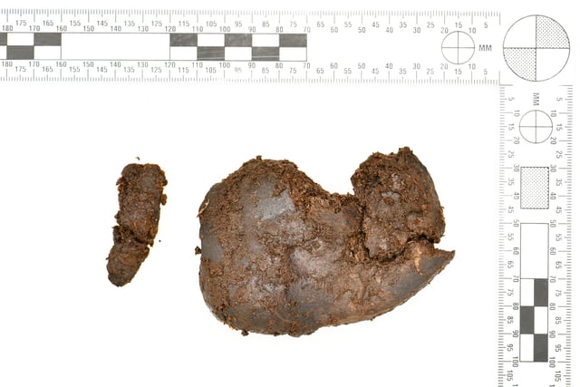 Picture of a kidney belonging to what is believed to be a teenage boy.