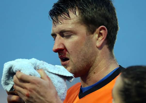 Glenavon's Gareth McKeown suffered a broken nose last weekend.