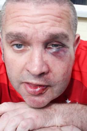 Assaulted: Darren Hutchinson was attacked because he was wearing a Rangers shirt, it's been claimed.