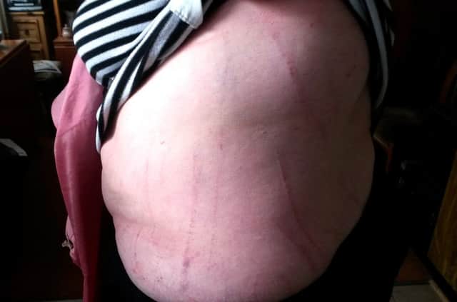 The woman attacked by the dog at Mossley Park suffered scrapes and bruises to her back and side. INNT 41-521CON