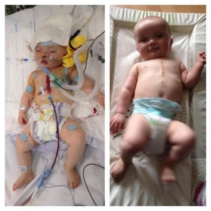 L-R: Baby Charlotte Paisley pictured just after her open heart surgery on April 30 and one week after the operation. INLT-20-716-con