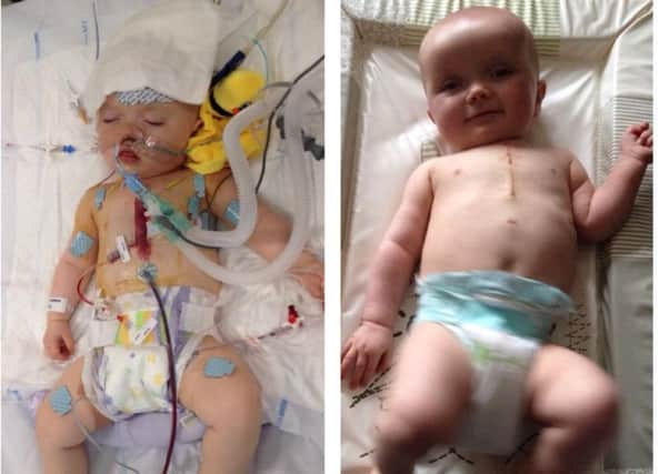 L-R: Baby Charlotte Paisley pictured just after her open heart surgery on April 30 and recovering after the operation. INLT-20-716-con