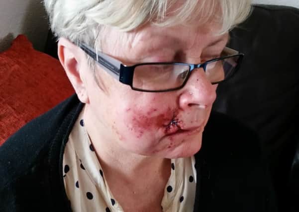Sandra Major lost four teeth and needed 30 stitches after the attack in Dungiven.