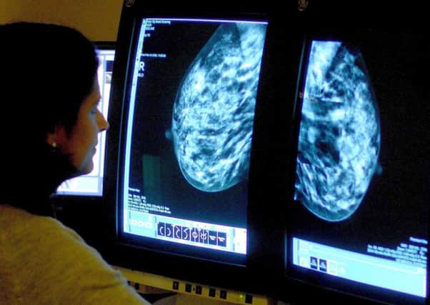 Taking the treatment to combat the effects of the menopause could mean that women are 2.7 times more likely to develop breast cancer than those who are not, a new study found. Photo: Rui Vieira/PA Wire