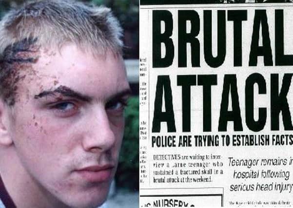 Ciaran Maxwell pictured after being attacked by a gang in Larne in 2002, and the Larne Times' headline at the time. INLT-05-704-con